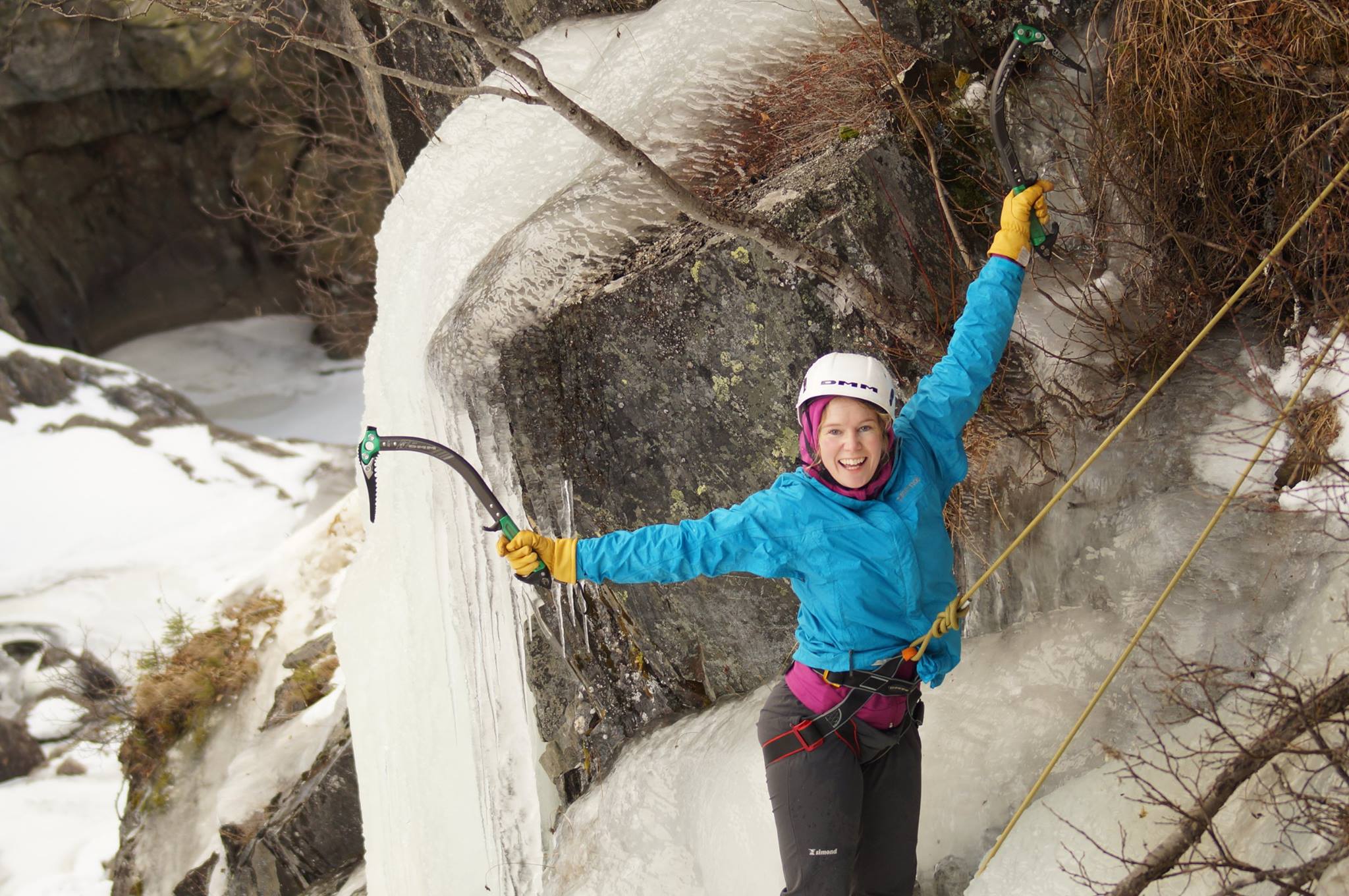 image_JU63MX2AATTBRCXR